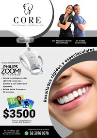 Philips Zoom es un sistema de blanqueamiento dental profesional que utiliza una luz LED para activar un gel especial de peróxido de hidrógeno. Este proceso acelera la eliminación de manchas y puede hacer que tus dientes sean hasta 8 tonos más blancos en una sola sesión. La rapidez y efectividad de Philips Zoom lo convierten en una elección popular.